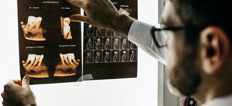 A doctor looking at X-rays which are held up against a bright lightbox