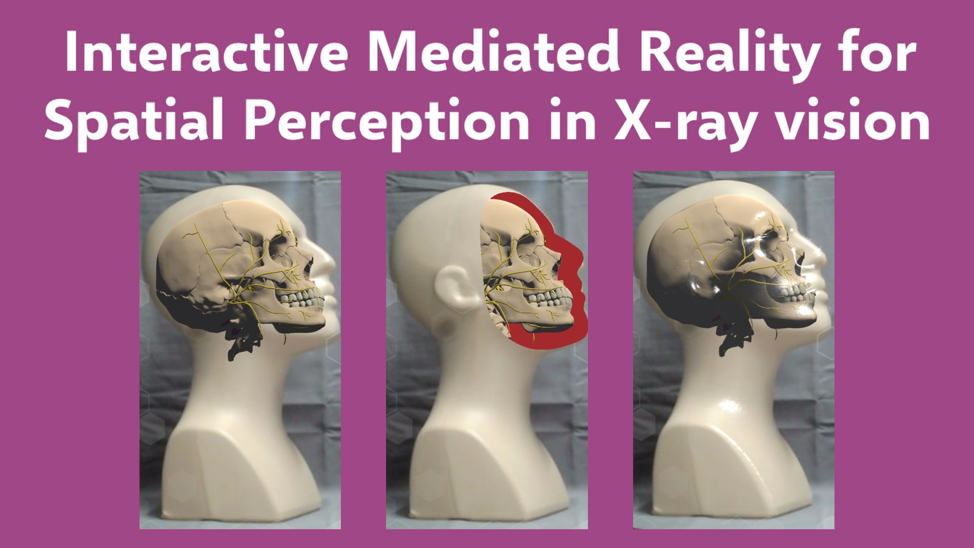 A pink background with white text that says: "Interactive Mediated Reality for Spatial Perception in X-ray vision". Below the writing are three images of skulls overlaid on a head statue.